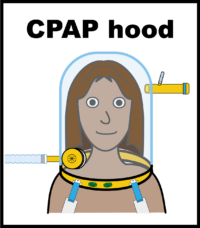 CPAP hood V2